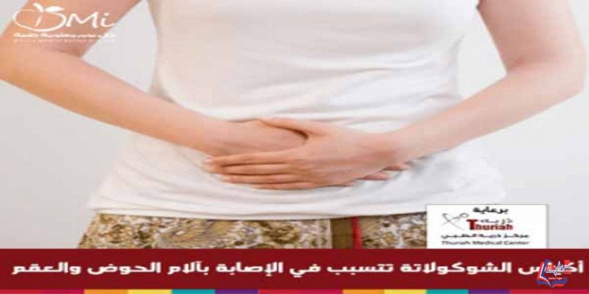 اكياس الشوكولاتة  تتسبب فى الاصابة بآلام الحوض والعقم