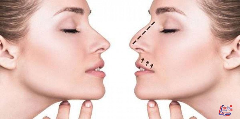 عمليات تجميل الأنف  ملف شامل