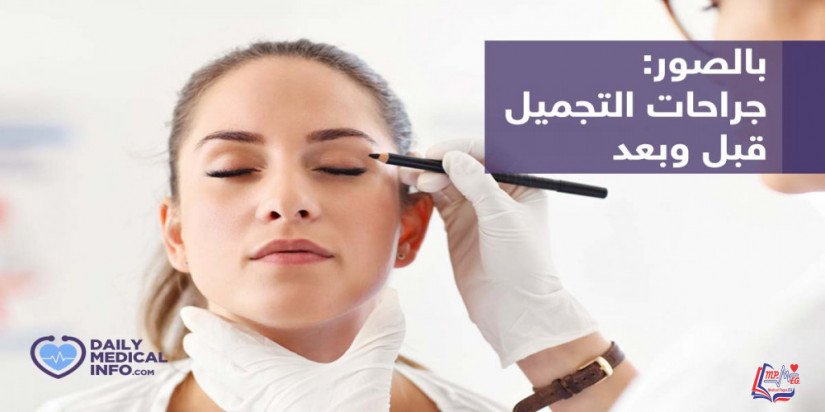 سلايد شو جميع الجراحات التجميلية بالصور قبل وبعد العملية