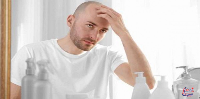 ملف شامل عن علاج الصلع بالأدوية و التقنيات الجراحية المختلفة