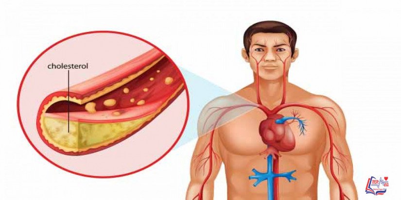 أطعمة تقلل الكوليسترول في الدم .. إليك 5 منهم اكتشفهم