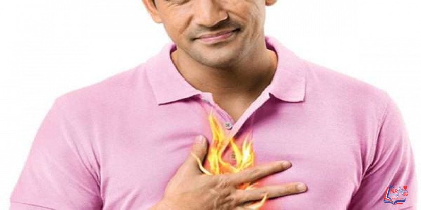 حموضة المعدة Heartburn