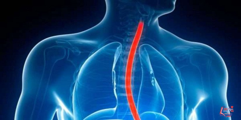 دوالي المرئ Esophageal varices