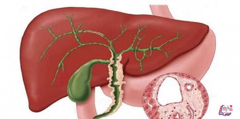 التهاب الأوعية الصفراوية المصلب الأولي Primary sclerosing cholangitis