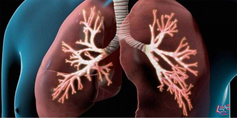 الانسداد الرئوي المزمن Chronic obstructive pulmonary