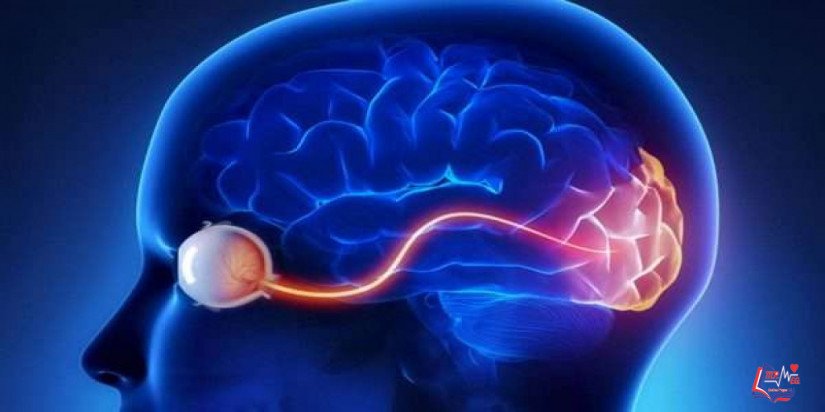 التهاب النخاع والعصب البصري Neuromyelitis optica