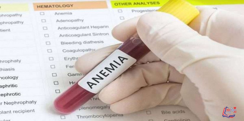 الانيميا Anemia