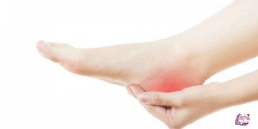 التهاب اللفافة الأخمصية Plantar fasciitis