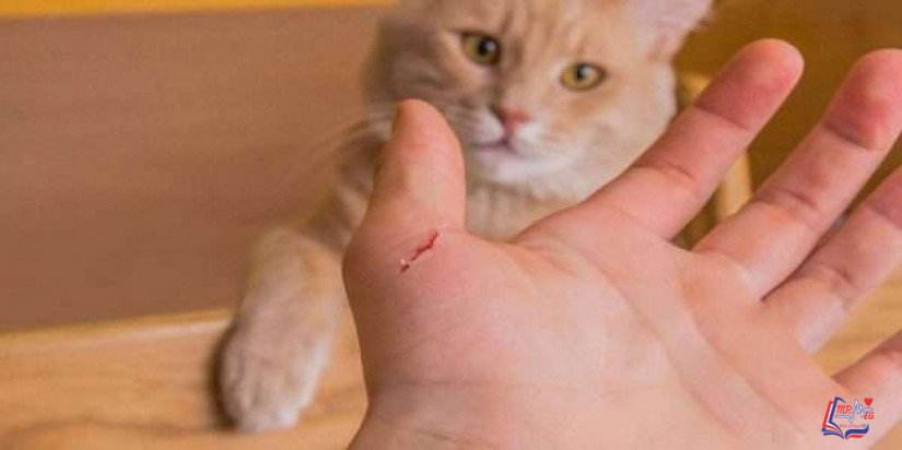 مرض خدش القطة Cat scratch disease