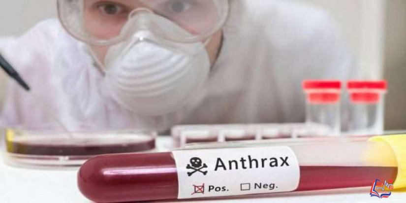 الجمرة الخبيثة Anthrax