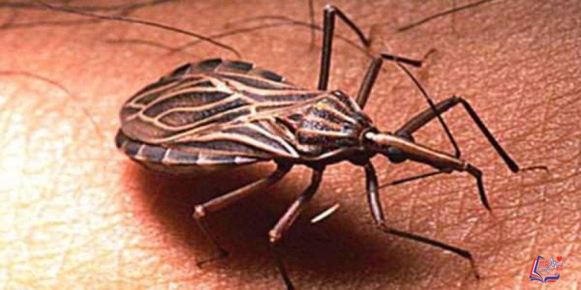 داء شاغاس Chagas