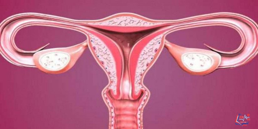 الحمل العنقودي Molar pregnancy